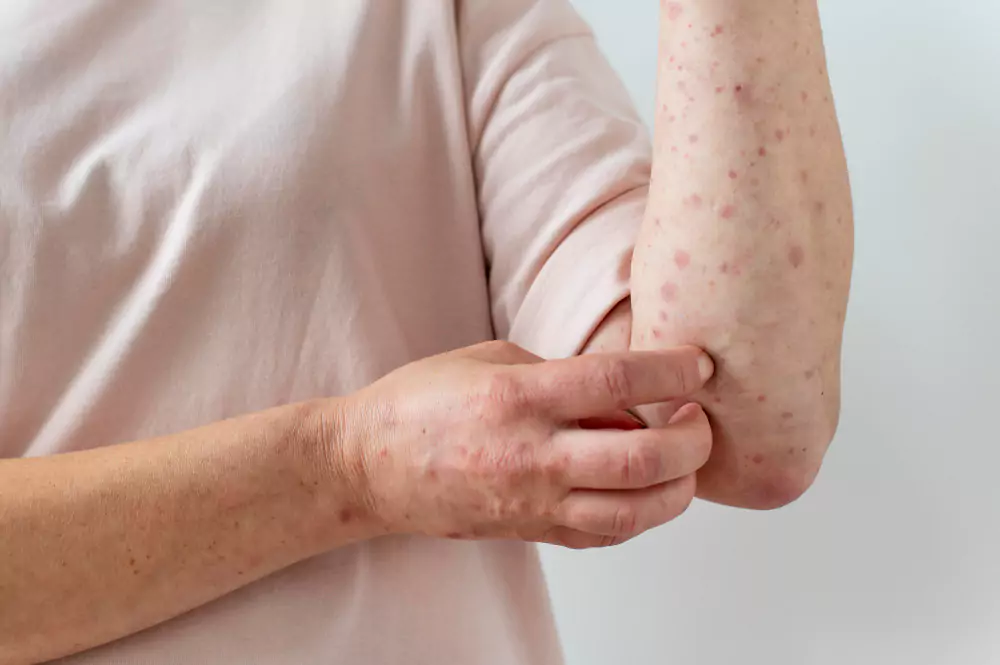 Skin Treatment